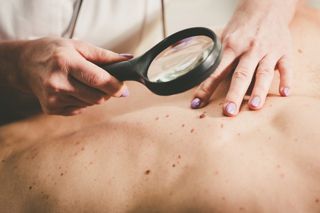 Dermatologist examining the skin on the back of a patient